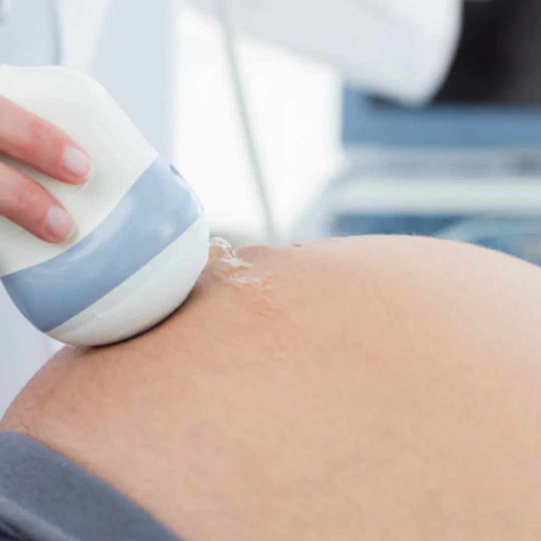 Doppler de Arterias Uterinas